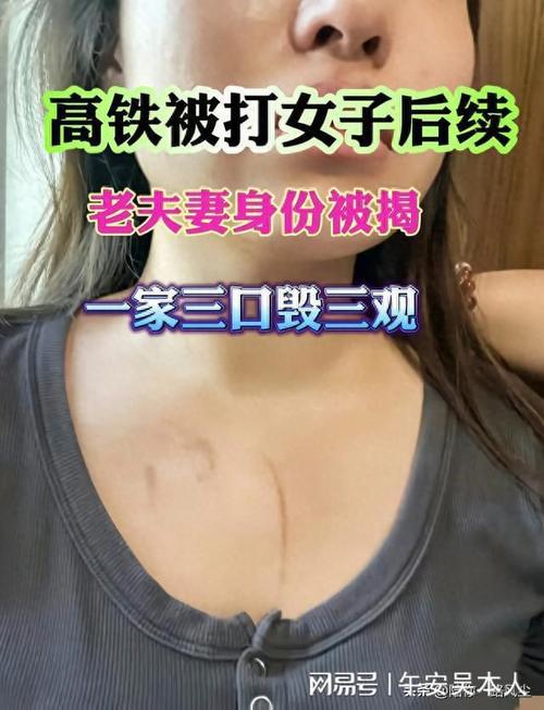 热点 第9页